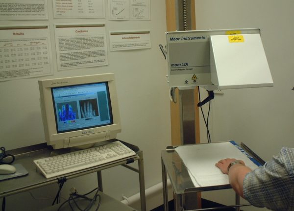 This machine measures blood flow in very small vessels. Here we are looking for Raynaud’s – spasm of microvessels in hands.